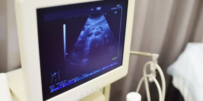 Bezpieczeństwo ultrasonografii prenatalnej